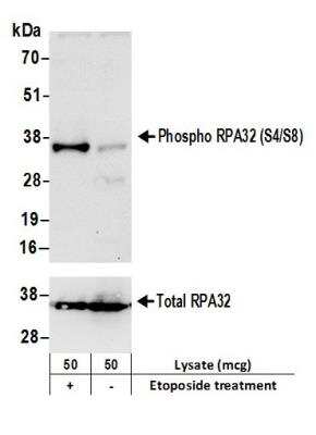 Western Blot: RPA2 [p Ser4, p Ser8] Antibody [NBP1-23017]